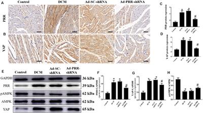 Effects of (Pro)renin Receptor on Diabetic Cardiomyopathy Pathological Processes in Rats via the PRR-AMPK-YAP Pathway